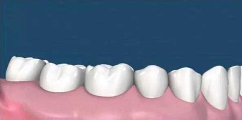 為(wei) 什麽(me) 要洗牙,洗牙的好處,洗牙,洗牙的過程,洗牙後的注意事項