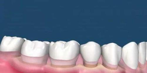 為(wei) 什麽(me) 要洗牙,洗牙的好處,洗牙,洗牙的過程,洗牙後的注意事項