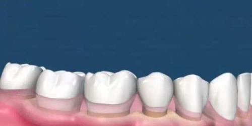 為(wei) 什麽(me) 要洗牙,洗牙的好處,洗牙,洗牙的過程,洗牙後的注意事項