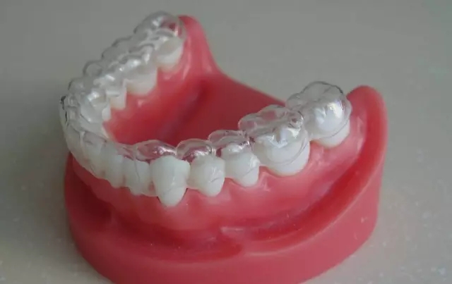 保持器需要佩戴多長時間