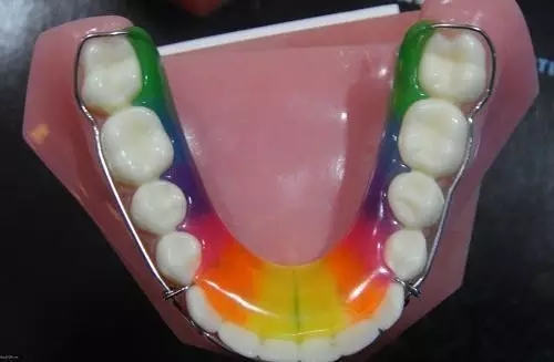 矯正後為(wei) 什麽(me) 一定要戴保持器