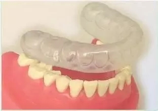 矯正後為(wei) 什麽(me) 一定要戴保持器