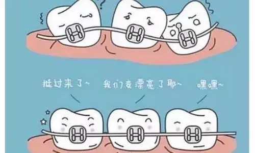 炎熱夏季做牙齒矯正真的好嗎？   