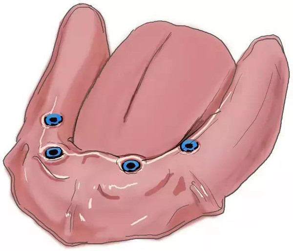 傳(chuan) 統鑲牙和種植牙的區別