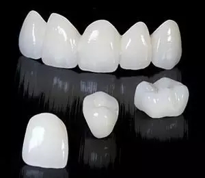 全瓷牙的好處你知道嗎？