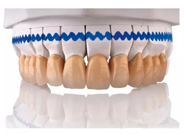 烤瓷牙也需要按時做體(ti) 檢