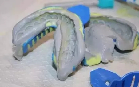 隱形矯正的程序