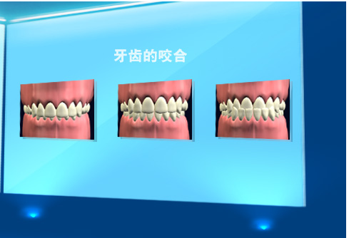 牙齒咬合錯位怎麽(me) 辦