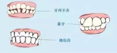 什麽(me) 才是正常的咬合？