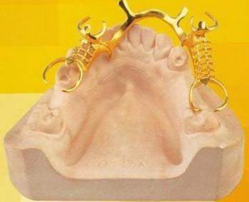 缺牙不鑲牙壞處多多