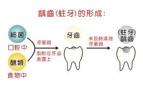孩子牙黃、有黑點,是得了齲齒嗎?