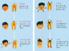 深圳兒童齲齒補一顆牙多少錢？
