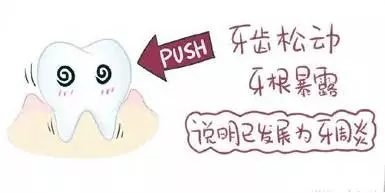 牙齒鬆動，如何治療?