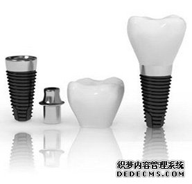 種植牙到底好不好