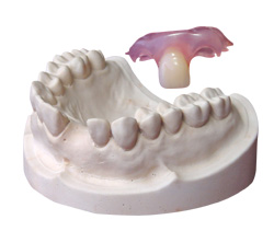 種植牙與(yu) 傳(chuan) 統假牙比具有哪些優(you) 勢