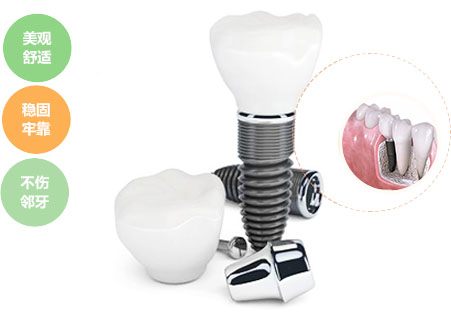 種植牙的過程是怎樣的？