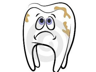 什麽(me) 方法可以預防牙結石？