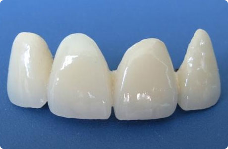 正規口腔醫院做烤瓷牙多少錢