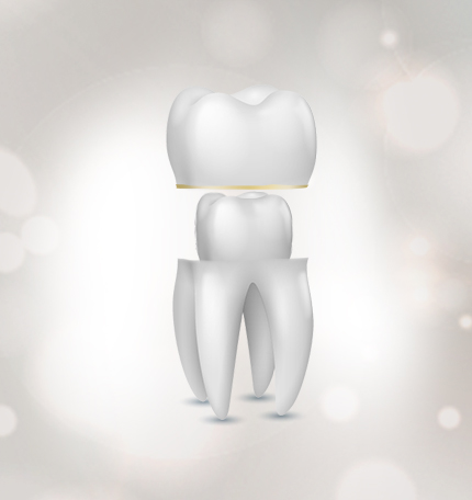 全瓷牙及烤瓷牙**