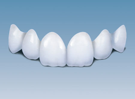 金屬牙套和烤瓷牙套哪個(ge) 比較好