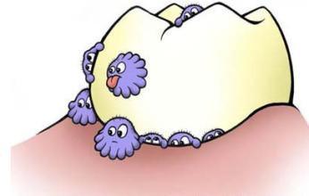 兒(er) 童蛀牙怎樣預防