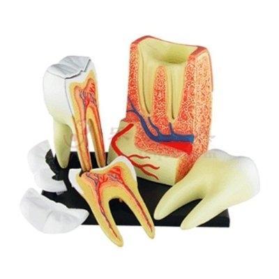 深圳哪家醫院做根管治療好