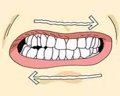 兒(er) 童牙齒矯正較佳時間