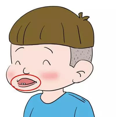 關(guan) 於(yu) 兒(er) 童偏側(ce) 咀嚼