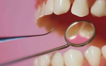 遺傳(chuan) 的牙髓炎怎麽(me) 解決(jue) 好?