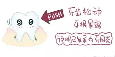 牙齒鬆動,是拔還是留!