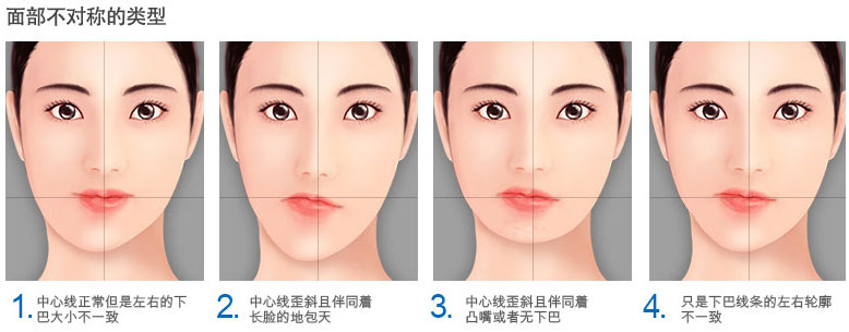 側(ce) 頜——臉型不對稱