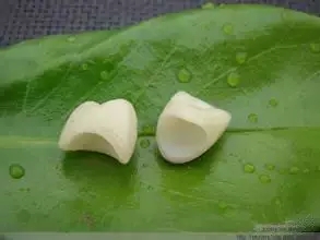 為(wei) 什麽(me) 要少做烤瓷牙連(聯)冠?