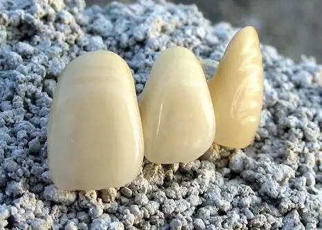 深圳做全瓷牙哪家醫院好?