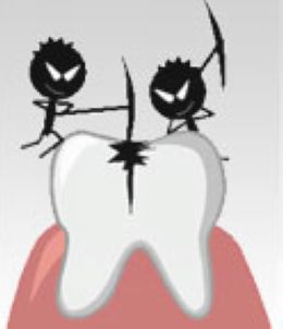 出現蛀牙時進行補牙很有必要