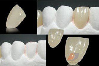 瓷貼麵產(chan) 品細節圖