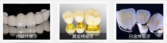 深圳即刻種植牙一般多少錢一顆