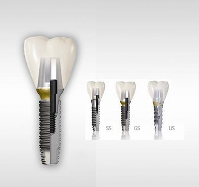  深圳微創即刻種植牙哪家醫院做得好