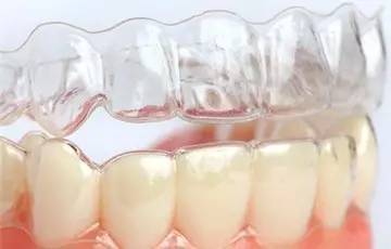 深圳透明牙套矯正牙齒多少錢 