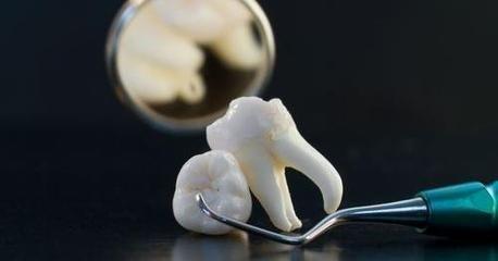 老年人可以做即刻種植牙嗎