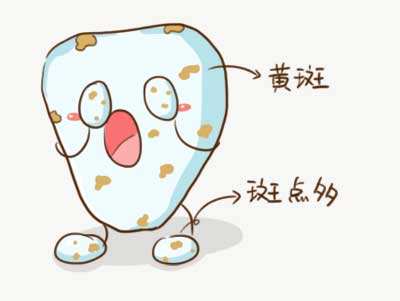 氟斑牙美白多少錢