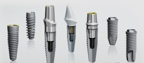 牙種植體(ti) 是什麽(me) 