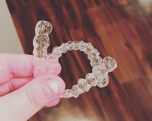 隱形矯正時間