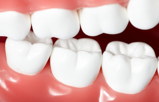 四環素牙怎麽(me) 變白