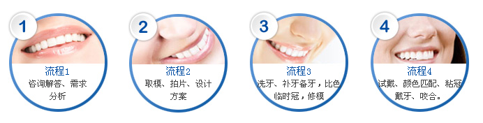 我適合哪一種貴金屬烤瓷牙