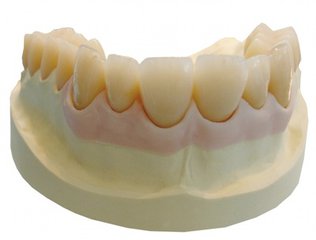 純鈦烤瓷牙的費用