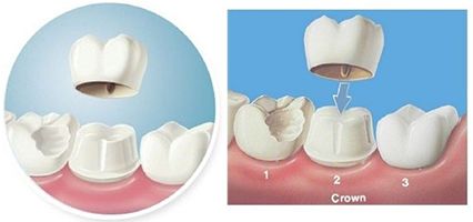 牙齒修複哪家醫院好