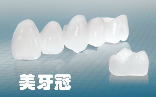 烤瓷牙牙冠多少錢