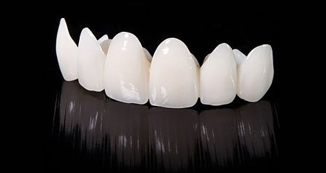 氧化鋯全瓷牙