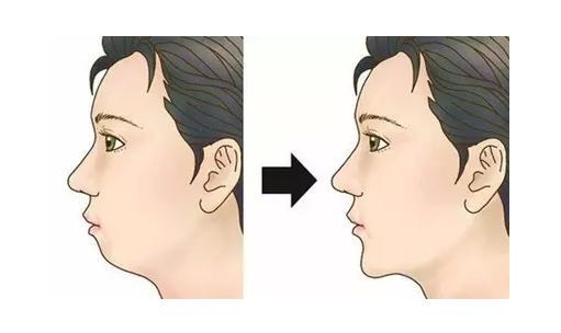 兒(er) 童兜齒怎麽(me) 辦