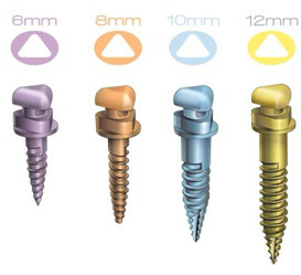 牙齒矯正打骨釘有什麽(me) 作用